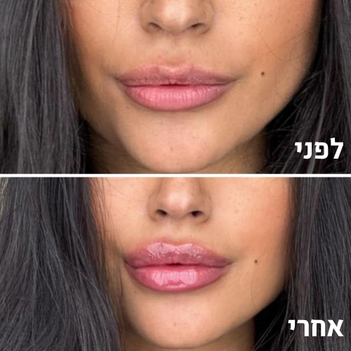 bloom – גלוס טבעי למראה שפתיים מלאות