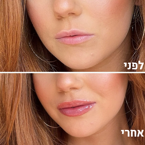 bloom – גלוס טבעי למראה שפתיים מלאות